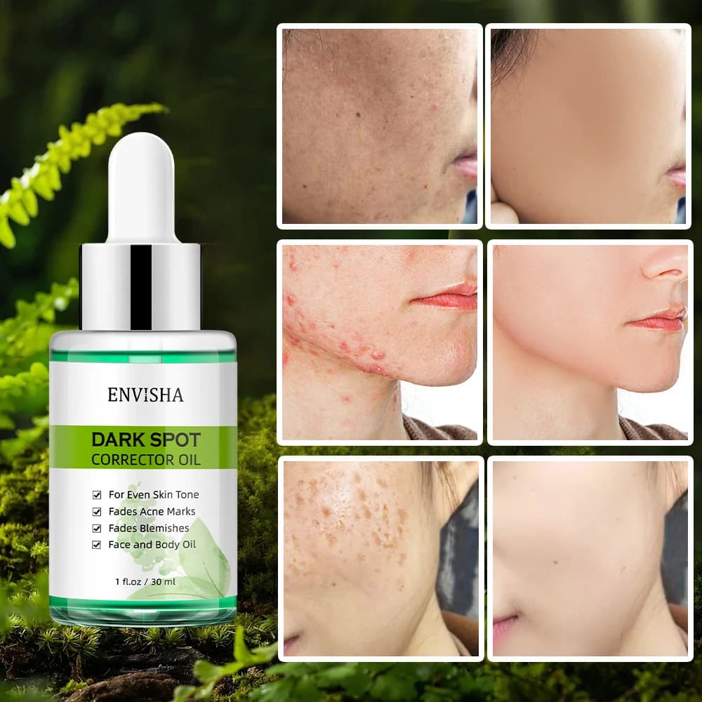 Sérum aux huiles essentielles pour les soins de la peau du visage