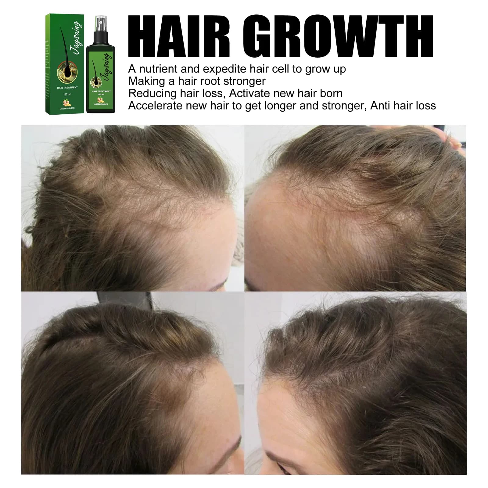Spray Capillaire au Gingembre : Favorise la Croissance, Anti-Chute, Améliore les Cheveux Fins, Secs et Cassants, Nourrit les Racines et le Cuir Chevelu, Traitement Réparateur pour la Repousse des Chev