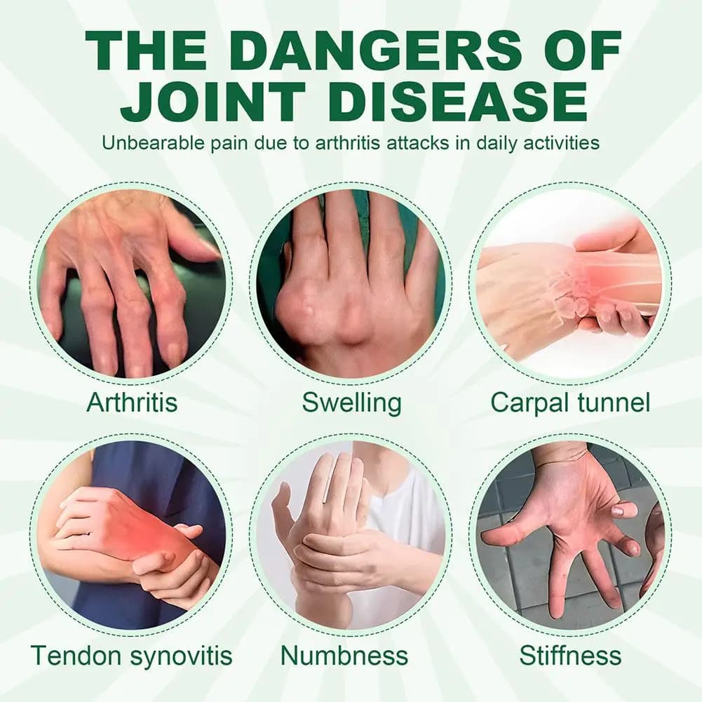 1 paire de gants pour soulager les douleurs articulaires, gants demi-doigts avec support de poignet pour soulager l'arthrite et réduire l'enflure des articulations