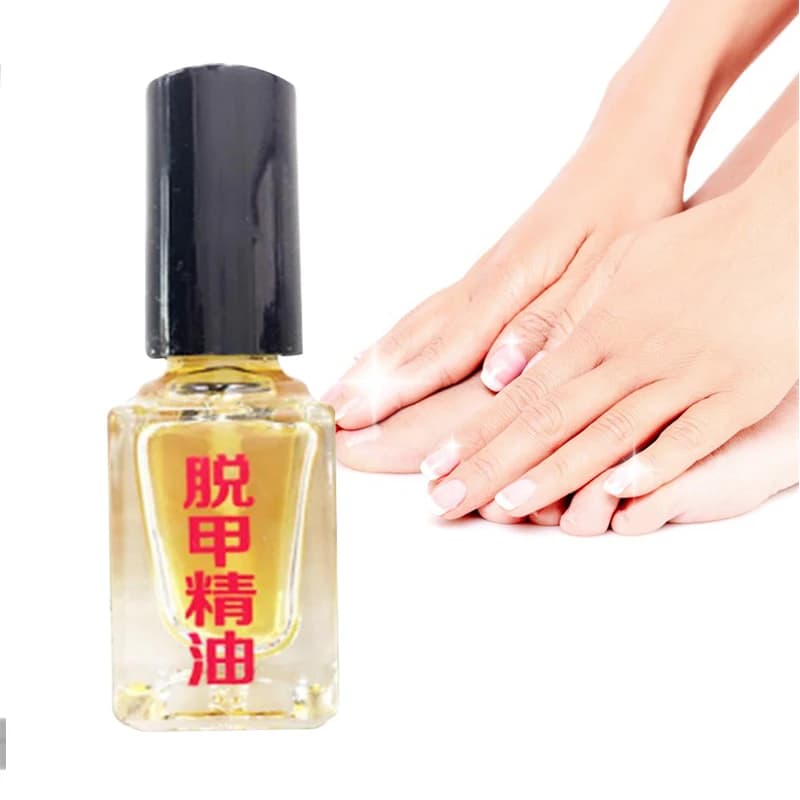 Liquide réparateur pour ongles, huile essentielle pour soins des pieds, enrichie en nutriments, pour ongles endommagés, doux et brillants, pour la protection des ongles, 5 pièces