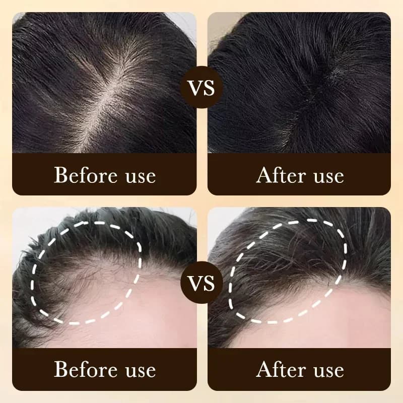 Traitement Essentiel de Repousse et de Croissance des Cheveux