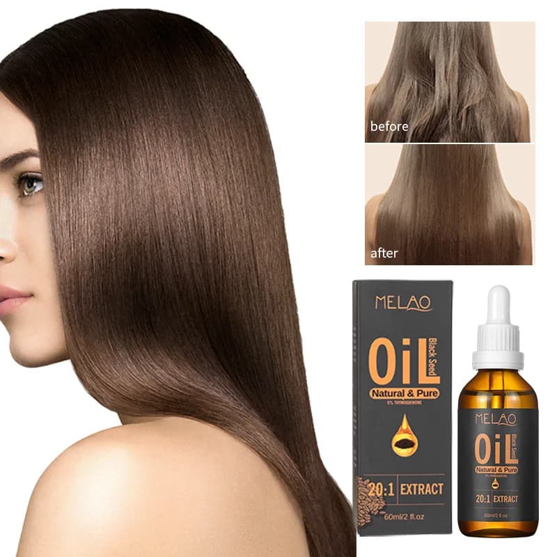 Huile de graines de cumin noir turc, huile de graines noires pressée à froid de qualité supérieure – 100 % pure pour les soins de la peau, la croissance des cheveux
