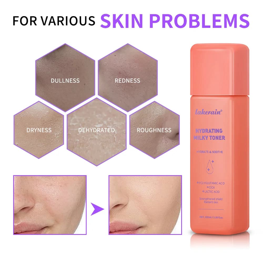 Toner laiteux hydratant pour réparer la peau, Toner Ultra hydratant pour le visage, apaise l'humidité de la peau, réduit les rougeurs, barrière, soins pour la peau