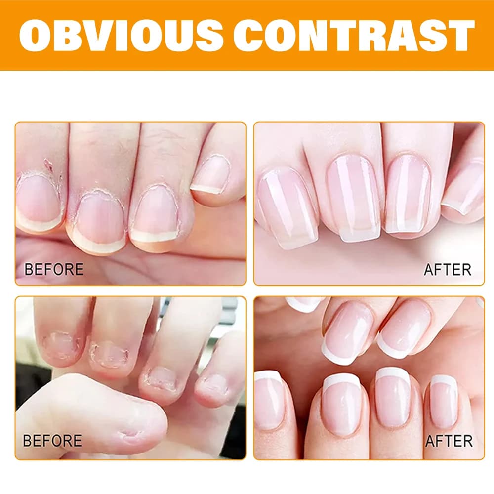 Huile de jojoba pour cuticules – Séchage rapide, soin hydratant, convient aux ongles doux, fragiles, répare la dégarnissure des ongles, améliore l'élasticité