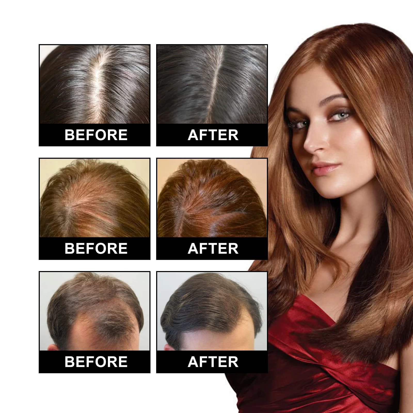 Ouhoe – huile de soin capillaire pour amincir les cheveux, sérum de traitement du cuir chevelu pour renforcer les racines et réparer les cheveux endommagés, formule naturelle 30ml