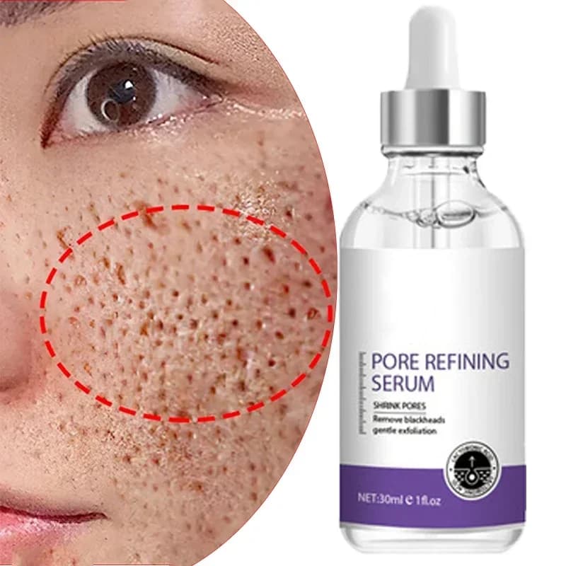 Skin Bergamo | Pore Refining Resurfacing, Sérum visage éclaircissant au rétinol et à la niacinamide non comédogène