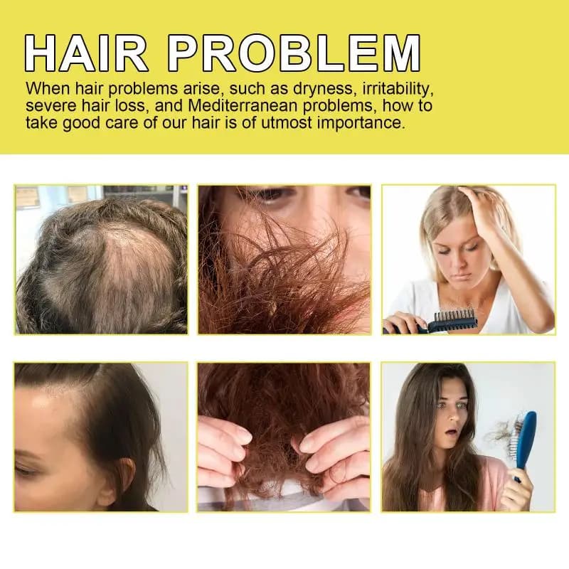 Huile de soin du cuir chevelu Hoegoa, nourrit les cheveux, hydrate le cuir chevelu, massage quotidien, soin nourrissant des cheveux, huile essentielle