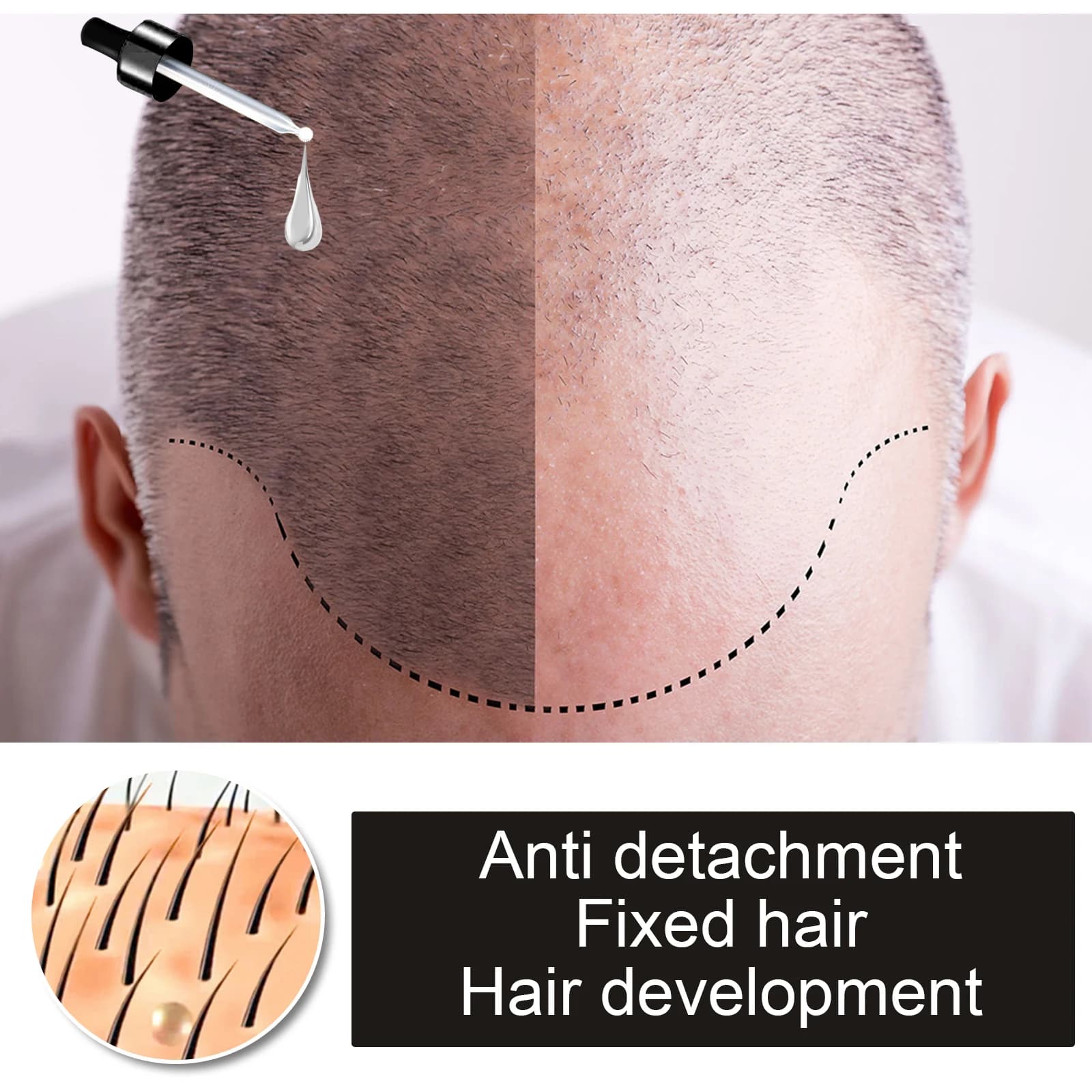 Huile essentielle pour le soin du cuir chevelu Polygonum Multiflorum, huile capillaire hydratante, non grasse, absorption rapide, traitement capillaire réparateur, nourrissant