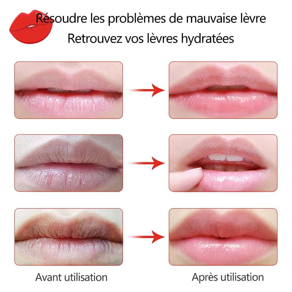 Masque pour les lèvres hydratant à la vitamine C aux fruits, réduction des rides, réparation des patchs pour les lèvres, masques de soins pour le visage, récréation des lèvres Sexy