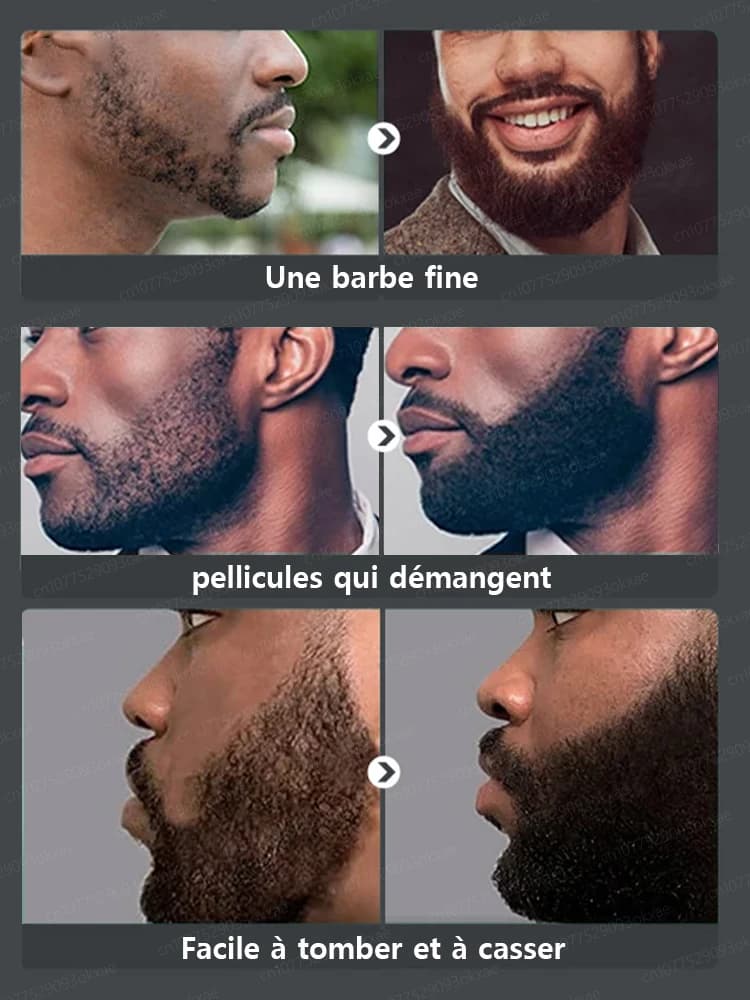 Essence de croissance de la barbe. Elle aide votre barbe à pousser rapidement et est un incontournable pour les hommes matures. Elle vous donne un air plus viril et est efficace de manière permanente.
