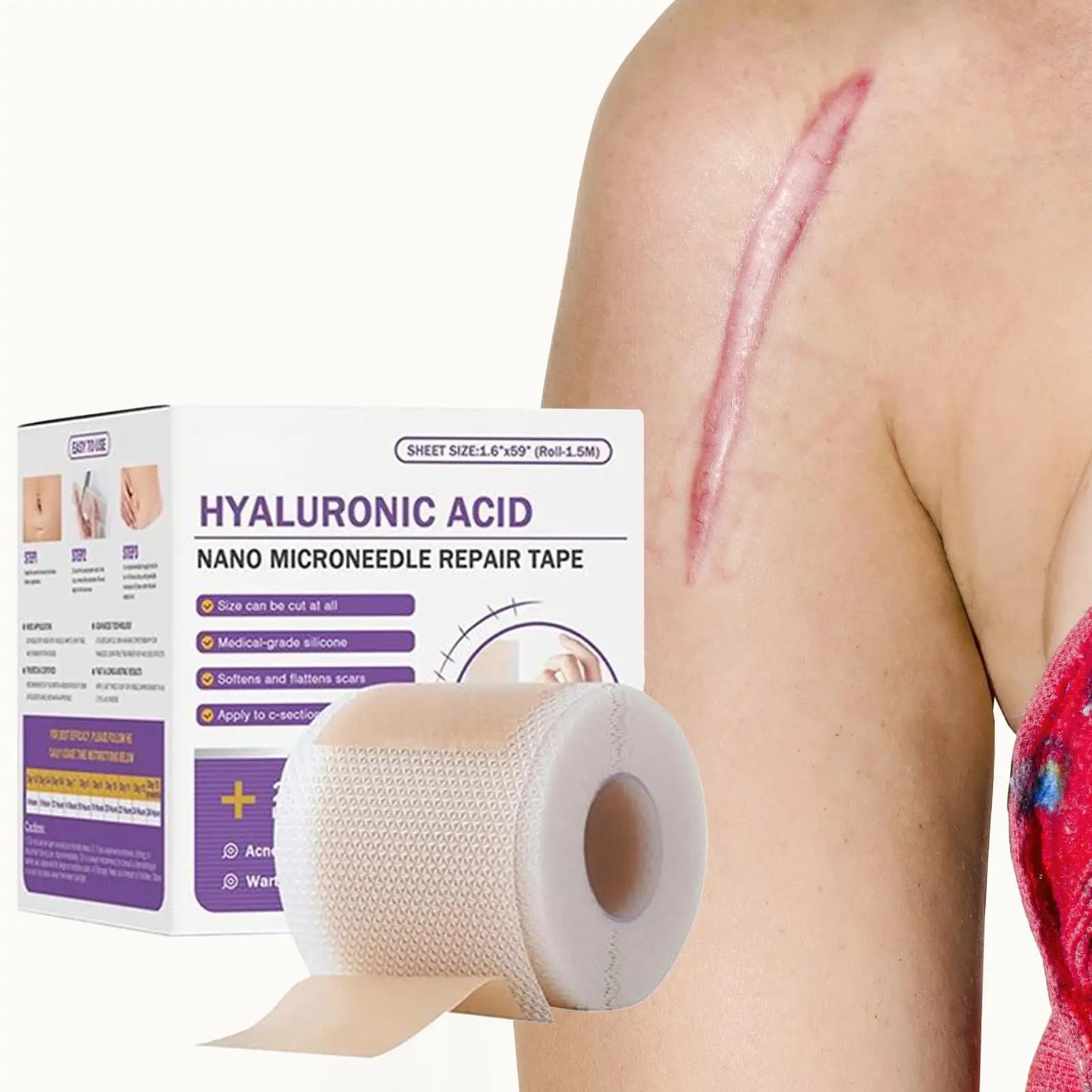 Feuille de cicatrice en Gel de Silicone souple chirurgical, Patch de traitement, bande d'élimination de l'acné, traumatisme, brûlure, couverture de cicatrice, Section de réparation de la peau, beauté 