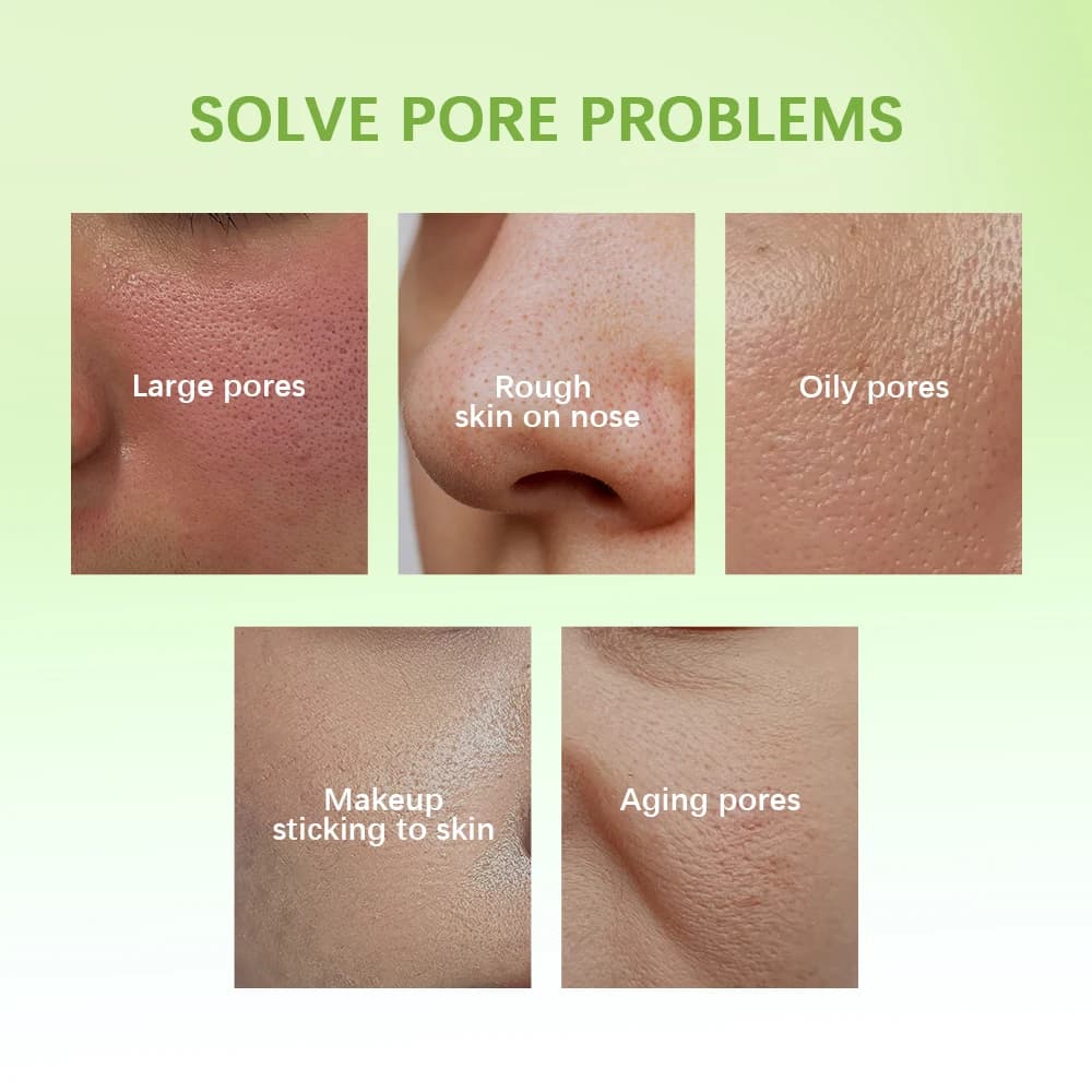 Lait Essence pour le contrôle de l'huile, 30ml, lisse les Pores et hydrate la peau avec une Essence rafraîchissante Non grasse, produits de soins pour la peau