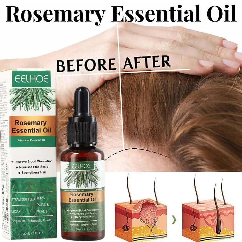 1 pièces huile essentielle de soin des cheveux au romarin huile de croissance des cheveux Anti-rupture prévention de la perte de cheveux traitement nourrissant du cuir chevelu huile de soin des cheveu