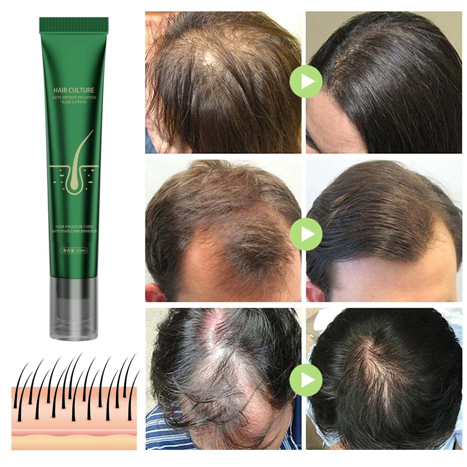 Huile essentielle de soin capillaire au gingembre naturel