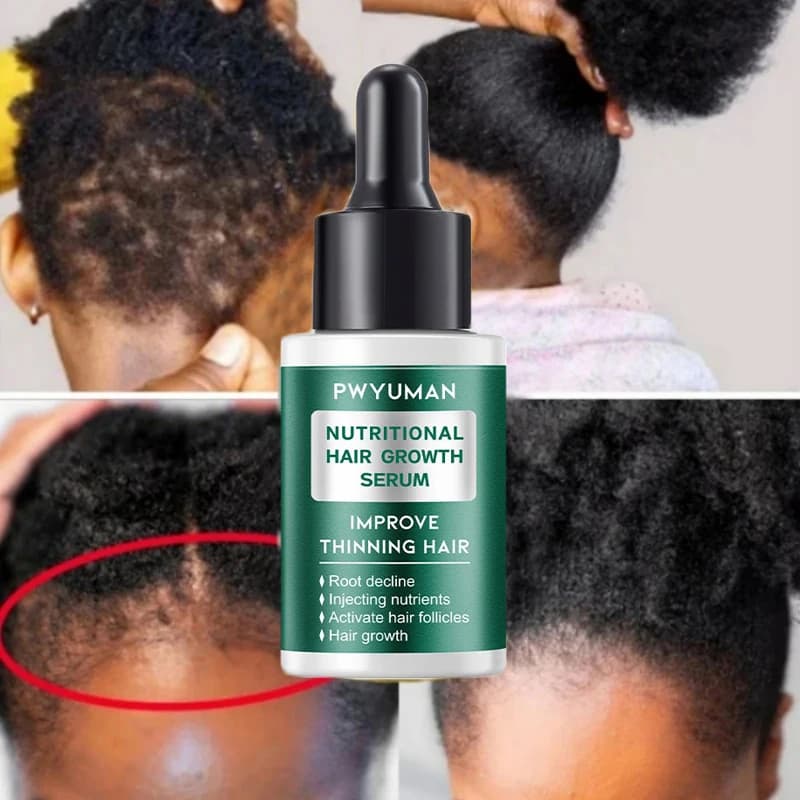 Sérum de croissance rapide des cheveux pour femmes et hommes, prévention de la perte de cheveux, repousse des cheveux, huile essentielle, réparation des racines des cheveux endommagés, soins capillair