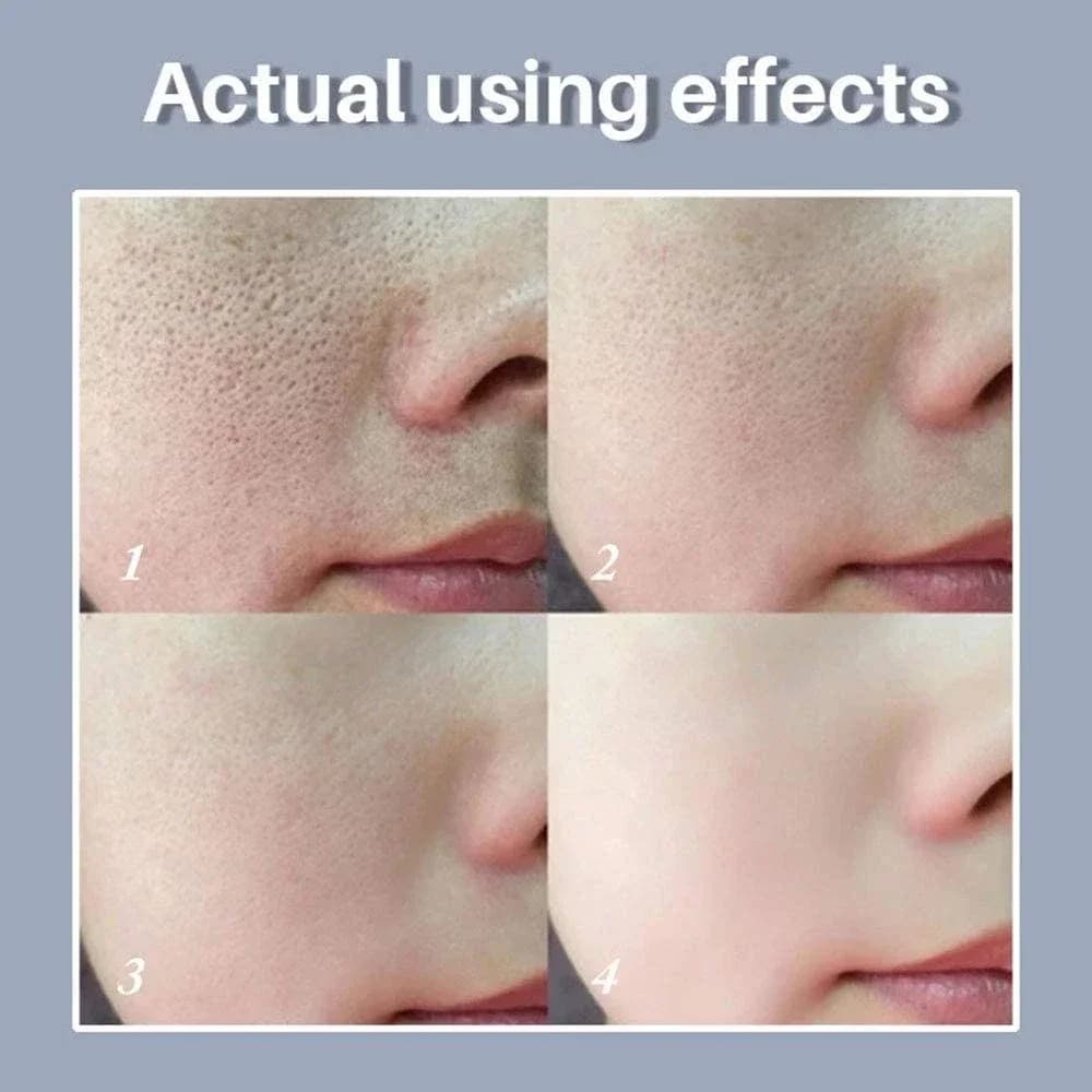 Skin Bergamo | Pore Refining Resurfacing, Sérum visage éclaircissant au rétinol et à la niacinamide non comédogène