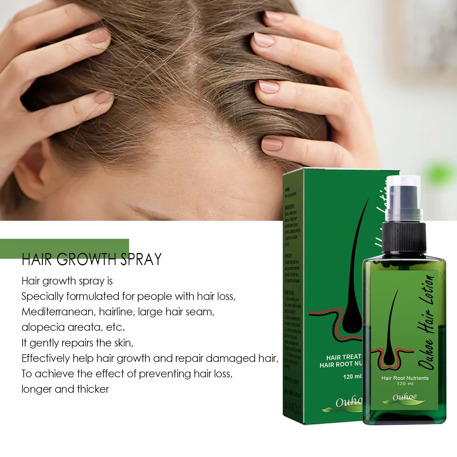 Spray Anti-perte de cheveux, réparation des racines des cheveux, traitement du cuir chevelu endommagé, sérum liquide épais, beauté plus longue, santé