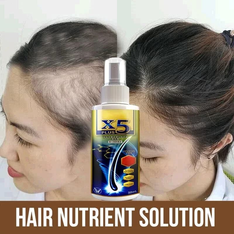 Huile essentielle naturelle anti-chute de cheveux pour femme, traitement capillaire, croissance rapide, alopécie
