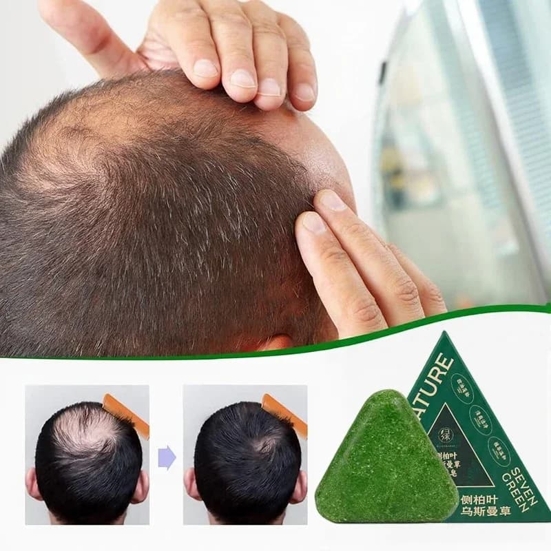 Shampoing à feuilles d'arborvitae orientales, savon, soulage les démangeaisons du cuir chevelu, renforce les racines des cheveux, contrôle de l'huile, Anti-pelliculaire, nouveau shampoing naturel