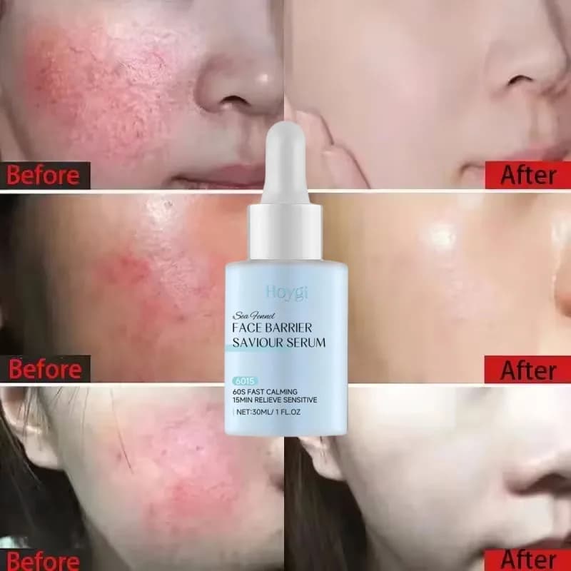 Sérum réparateur de rougeurs du visage