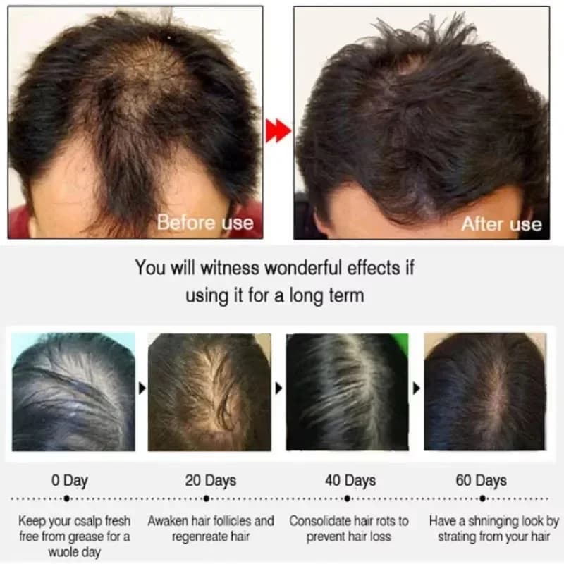 Sérum de croissance des cheveux 7 jours