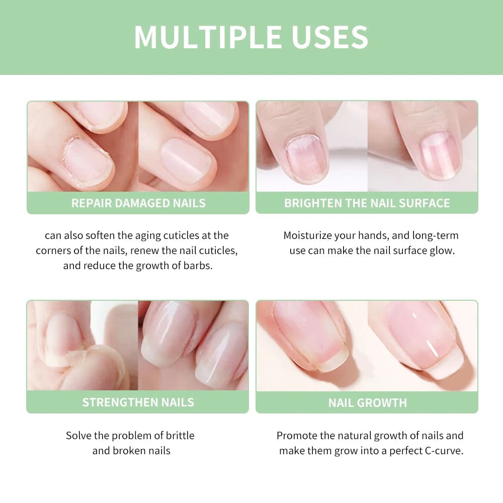 Huile de renforcement pour la croissance des ongles, 5ml, huile saine et forte pour la croissance des ongles, aide à fendre les ongles fins, réparation de manucure, huile pour cuticules