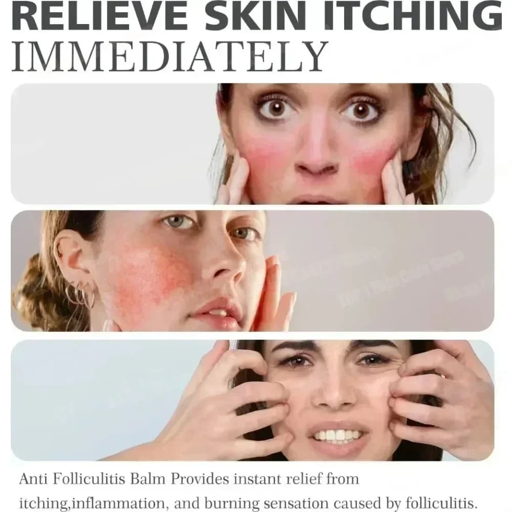 Crème Anti-acné élimine efficacement les Nodules de la peau Pustules Cysts Papules points noirs hommes et femmes acné crème d'essence de soin de la peau