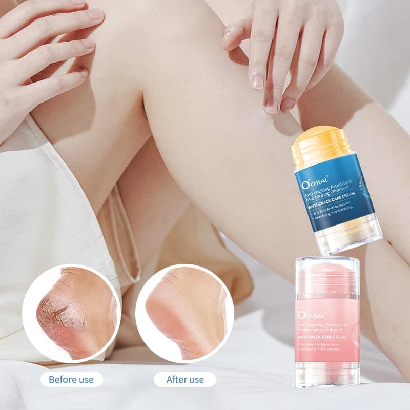 Crème anti-fissures pour pieds secs et craquelés et talons, pieds et talons secs hydratants, empêchant les pieds de fissuration