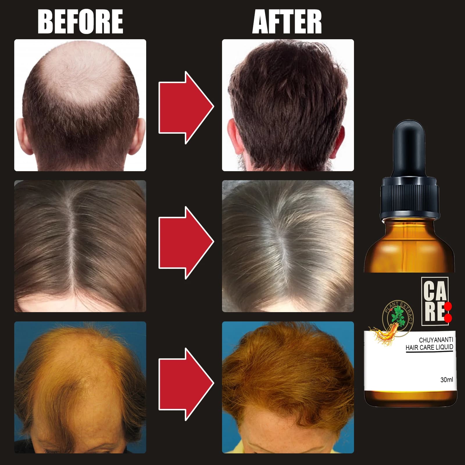 Huile essentielle pour le soin du cuir chevelu Polygonum Multiflorum, huile capillaire hydratante, non grasse, absorption rapide, traitement capillaire réparateur, nourrissant