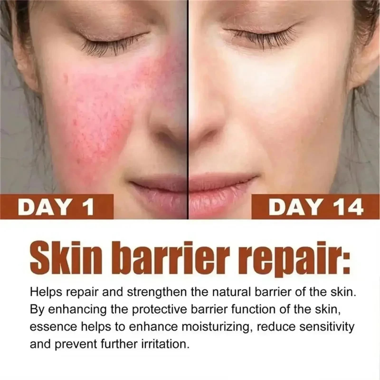Crème réparatrice pour les rougeurs du visage