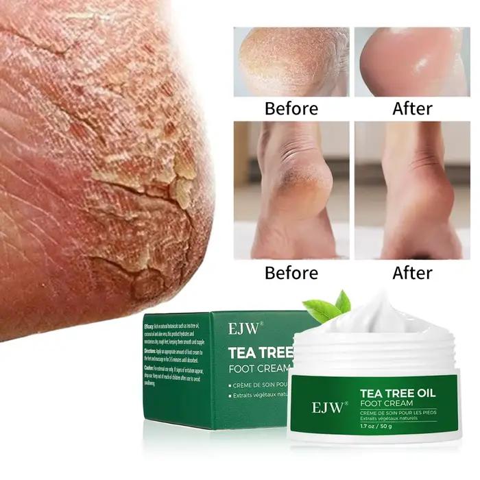Crème pour les pieds à l'huile d'arbre à thé