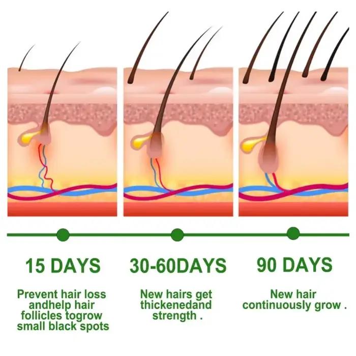 Huiles essentielles de romarin pour la croissance des cheveux