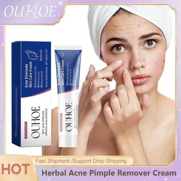 Crème pour le traitement de l'acné des boutons
