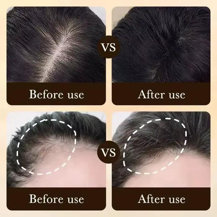 Faites-tu veux dire au revoir à la chute des cheveux? Nos produits peuvent pénétrer les follicules pileux et aider vos