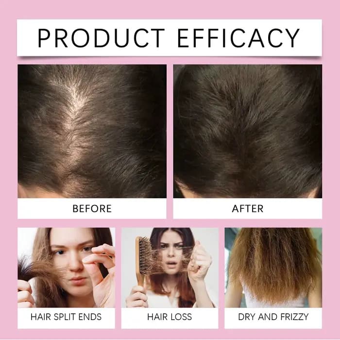 Huile Essentielle de Romarin pour Cheveux : Renforce le Cuir Chevelu