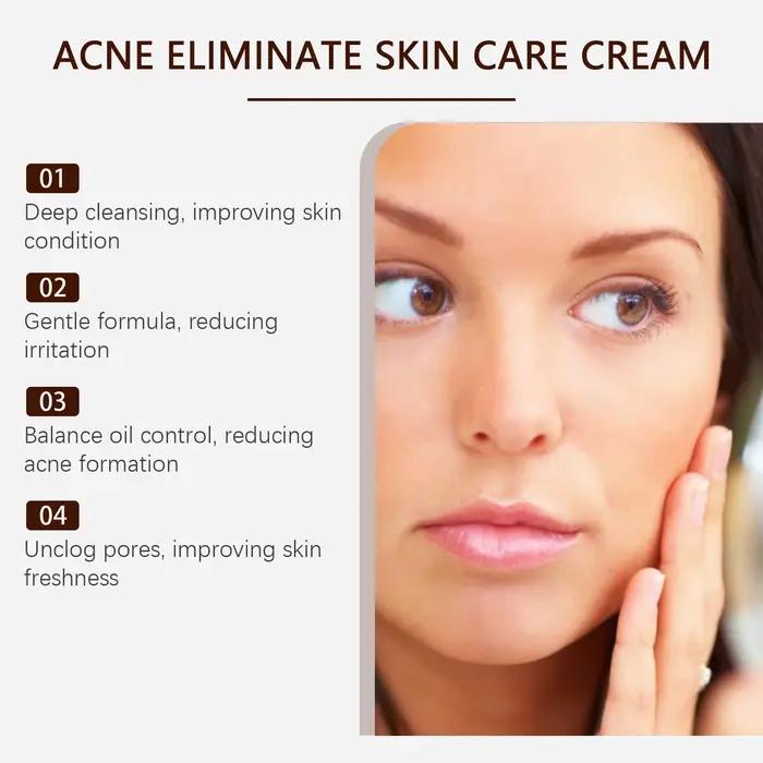 Crème pour le traitement de l'acné des boutons
