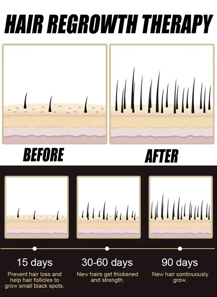 L'essence anti-chute de cheveux favorise la croissance
