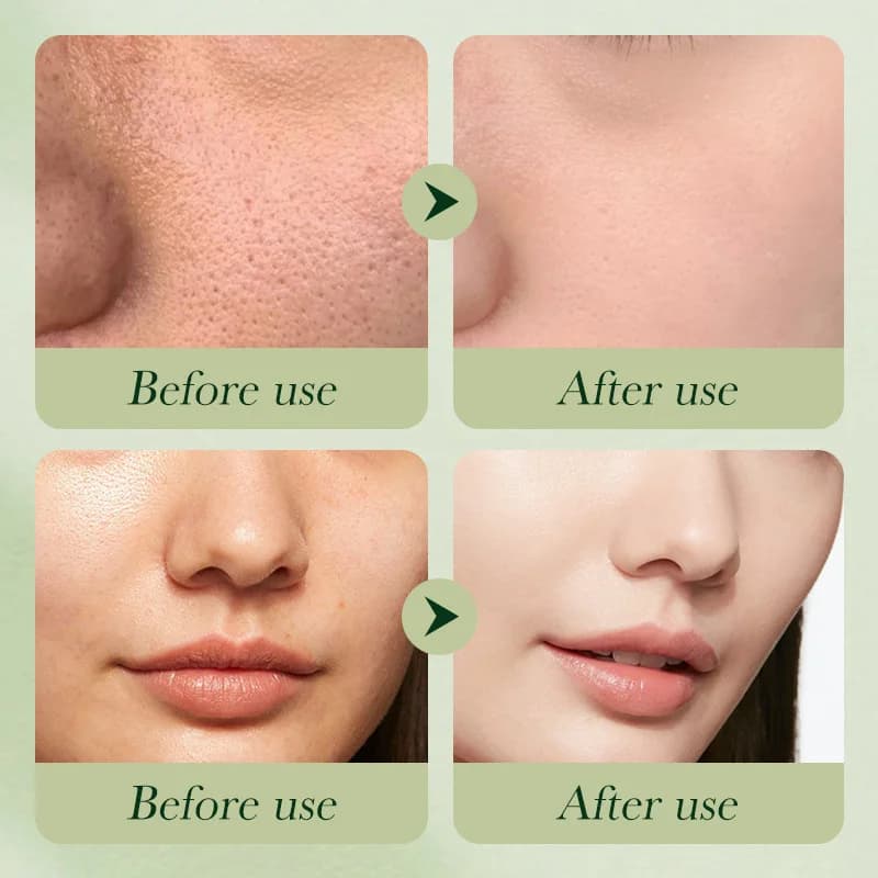L'ensemble de 6 pièces de soin de la peau d'avocat comprend une crème nourrissante et hydratante pour les yeux, une crème pour le visage et des produits de soin anti-rides.