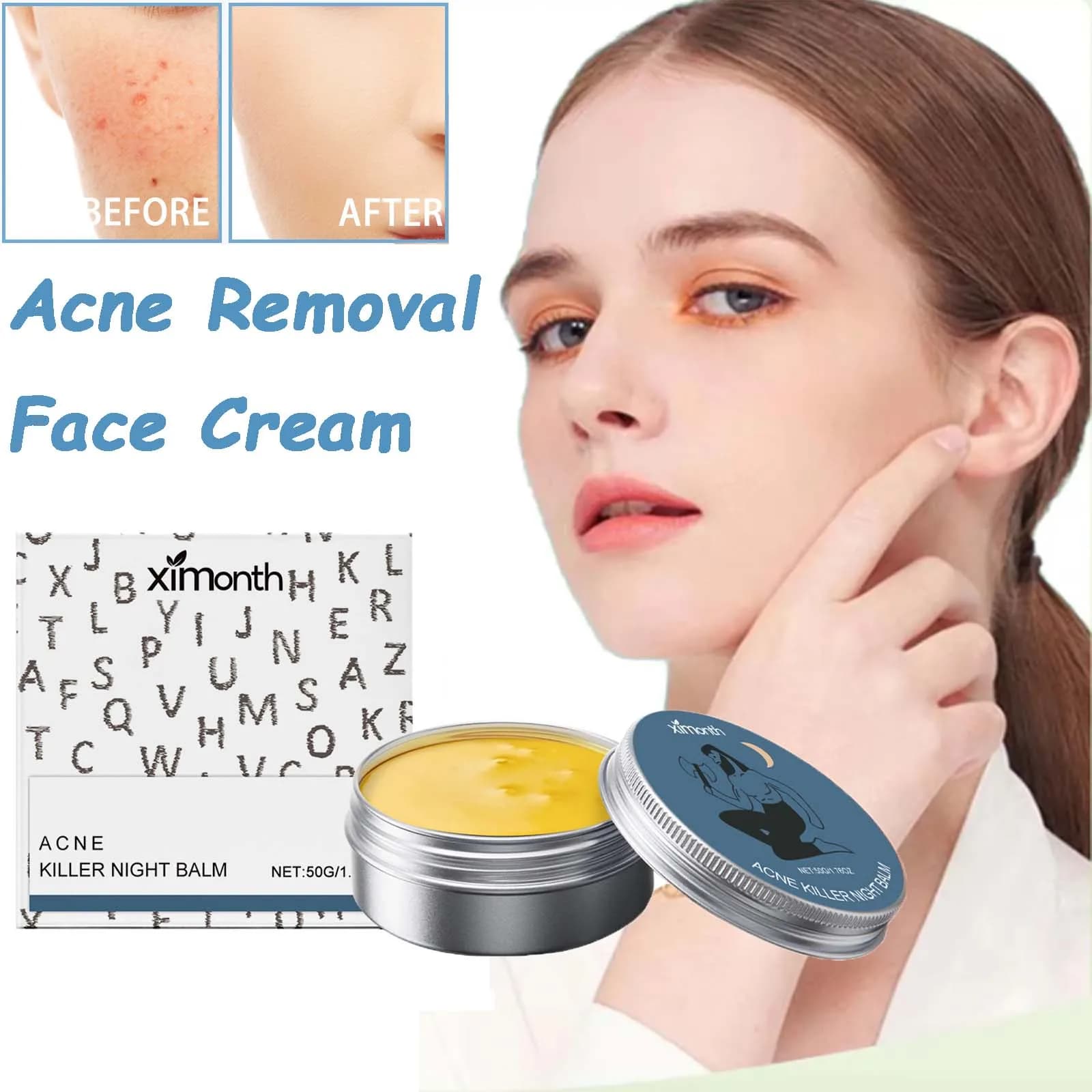 Crème pour le visage pour l'élimination de l'acné, équilibre en douceur, huile rafraîchissante, soins pour la peau, rétrécit les Pores, contrôle du sébum, crème hydratante Anti-acné