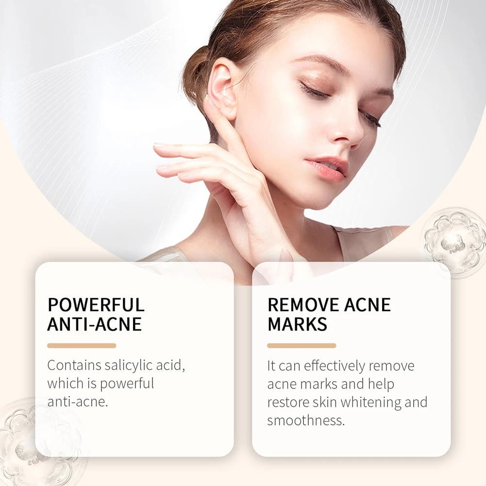 Crème pour le visage à l'extrait naturel de Calendula, 50g, pour l'acné hormonale, apaise les rougeurs, calme l'acné, crème à base de plantes pour peau grasse