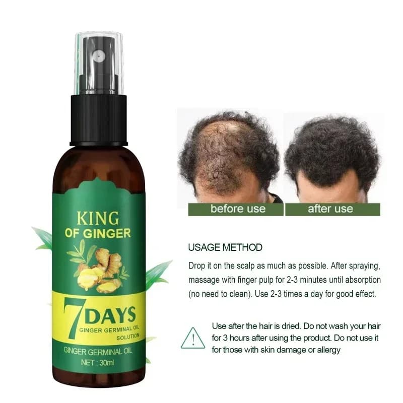 Spray de croissance des cheveux au gingembre, Massage renforcé du cuir chevelu, renforcement des cheveux denses, prévention de la perte de cheveux, liquide nourrissant réparateur