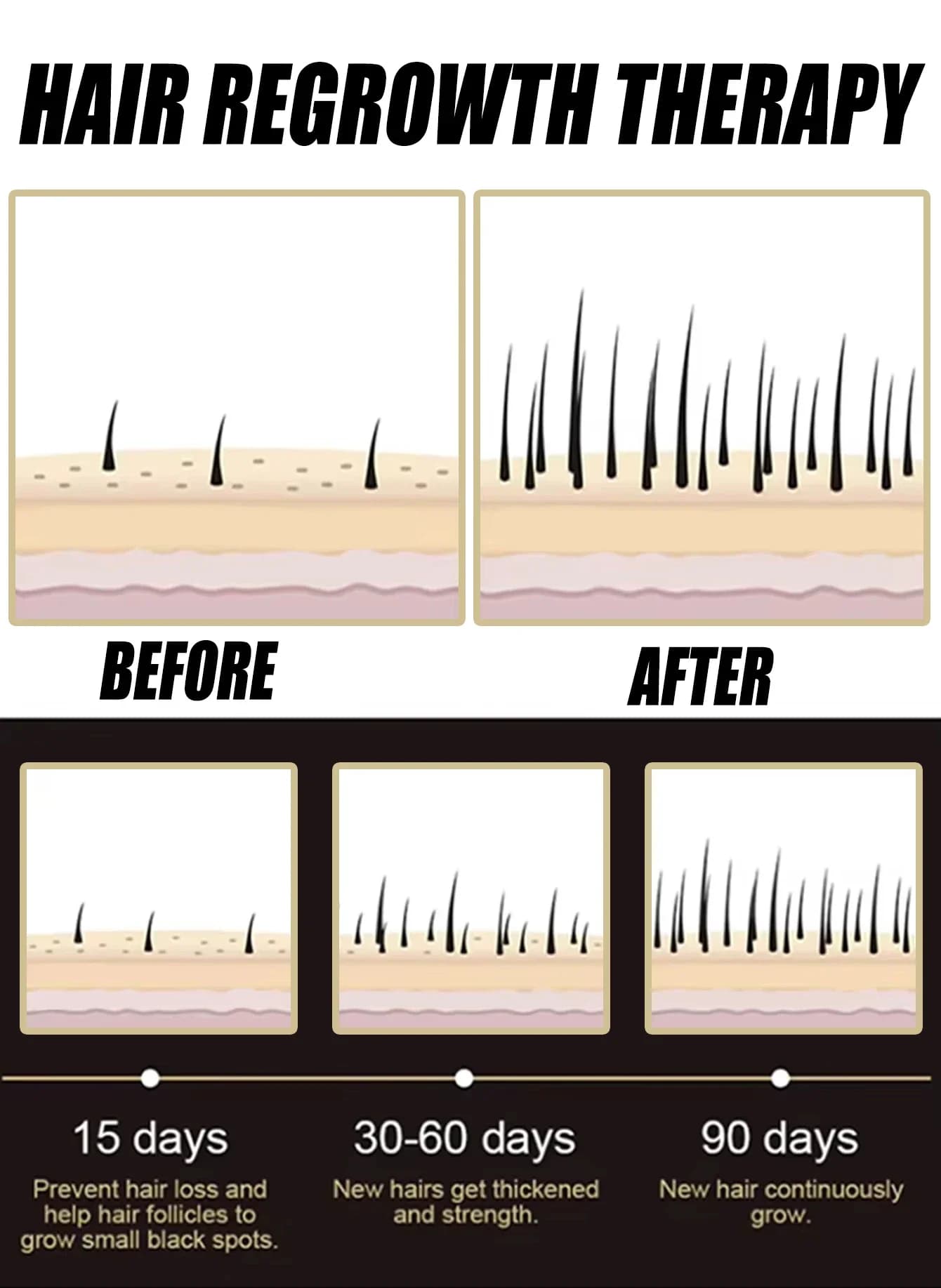 L'essence anti-chute de cheveux favorise la croissance des cheveux et améliore l'environnement du cuir chevelu