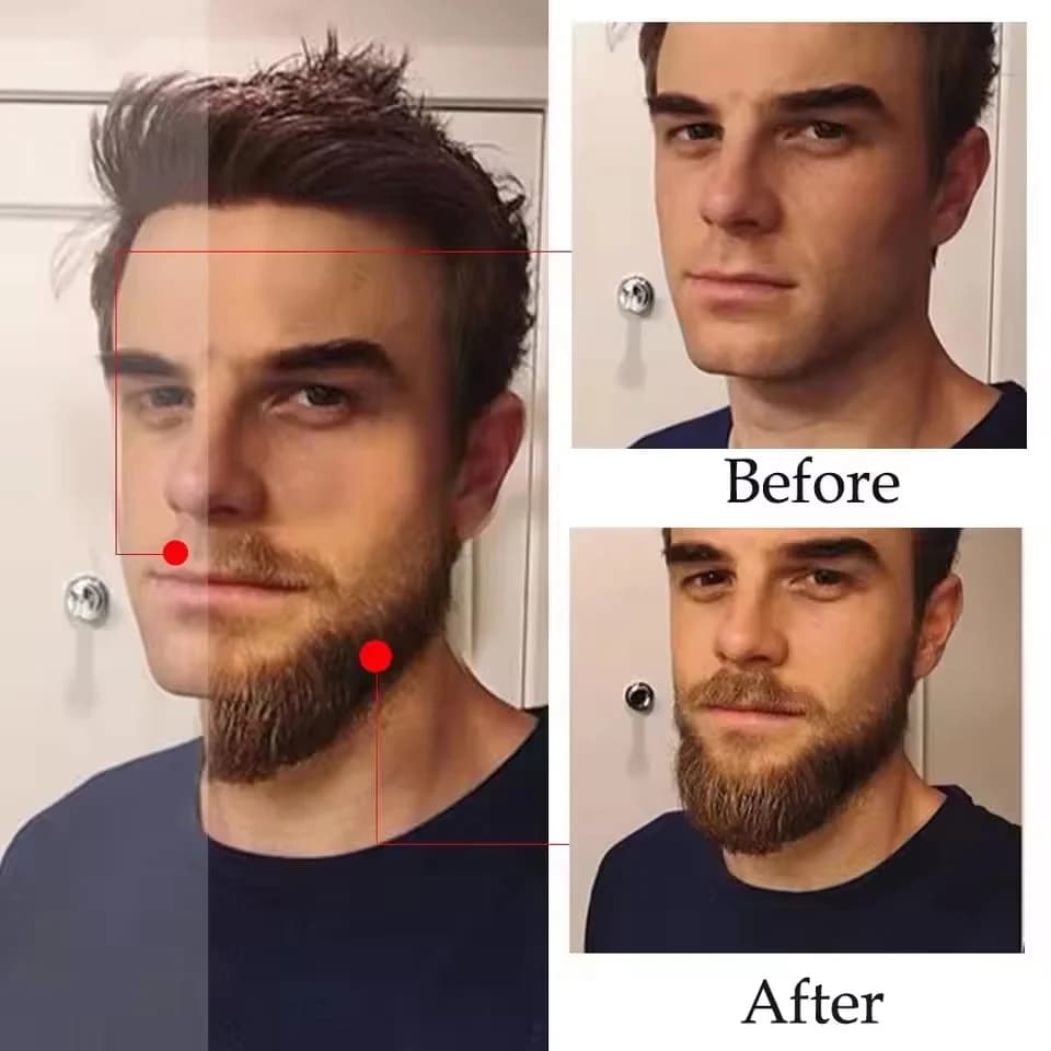 Sérum de croissance rapide de la barbe de haute qualité pour hommes