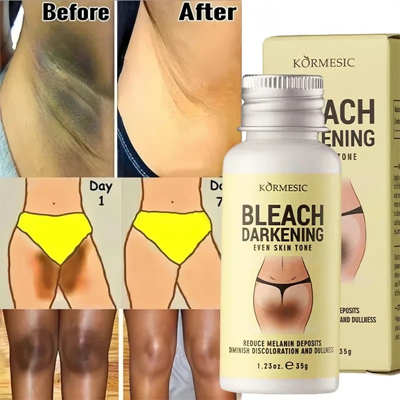 Crème blanchissante pour le corps, parties intimes, sérum blanchissant pour les aisselles, blanchit les fesses et les genoux, éclaircit l'intérieur des cuisses, intime, foncé, élimine la mélanine