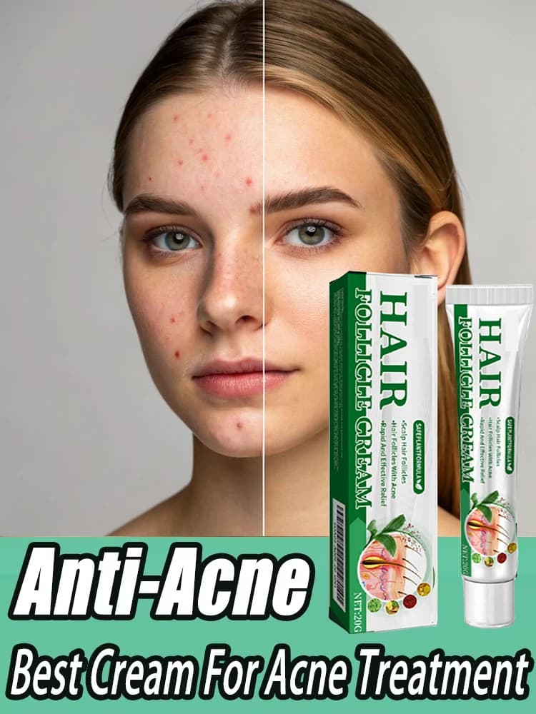 3ème crème Anti-acné efficace élimine les Nodules de la peau Pustules Cysts Papules points noirs hommes et femmes acné soin de la peau crème Essence