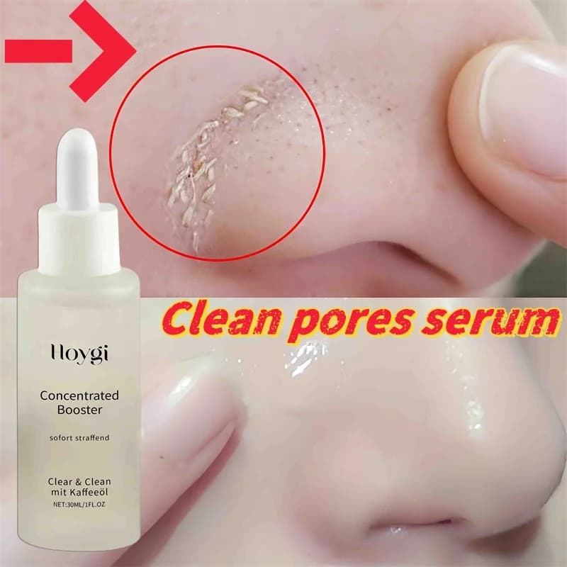 Sérum pour nettoyer les Pores du visage, délicat, tendre, hydratant, contrôle de l'huile, rétrécit les Pores, peau rugueuse, soins lisses, éclaircissant, cosmétiques coréens