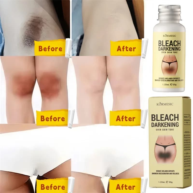 Crème blanchissante pour le corps, parties intimes, sérum blanchissant pour les aisselles, blanchit les fesses et les genoux, éclaircit l'intérieur des cuisses, intime, foncé, élimine la mélanine