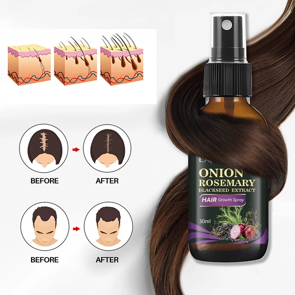 Huile Essentielle pour la Croissance Rapide des Cheveux, Huile Essentielle pour Soins des Cheveux à l'Oignon et au Romarin, Produit Efficace Contre la Chute des Cheveux, Régénération Capillaire