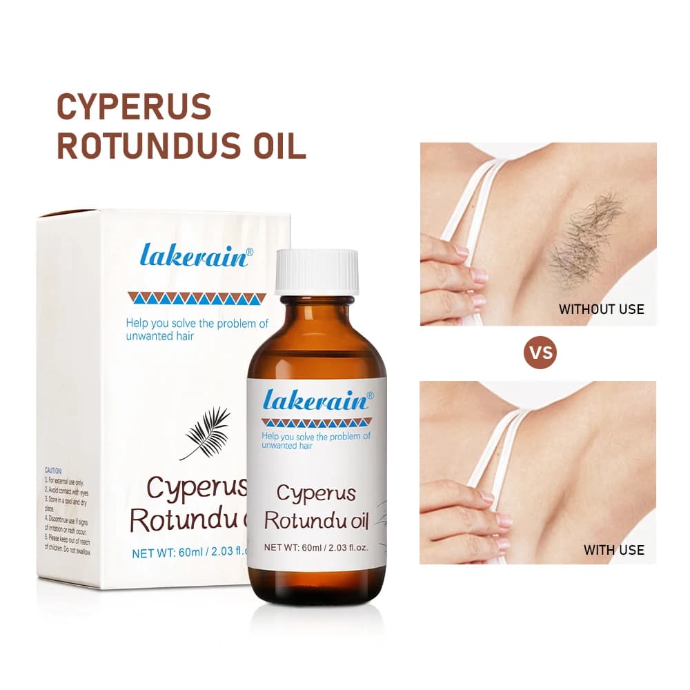 Inhibe la croissance des cheveux 60 ml d'huile de Cyperus Rotundus nourrit les ingrédients de la peau sont en toute