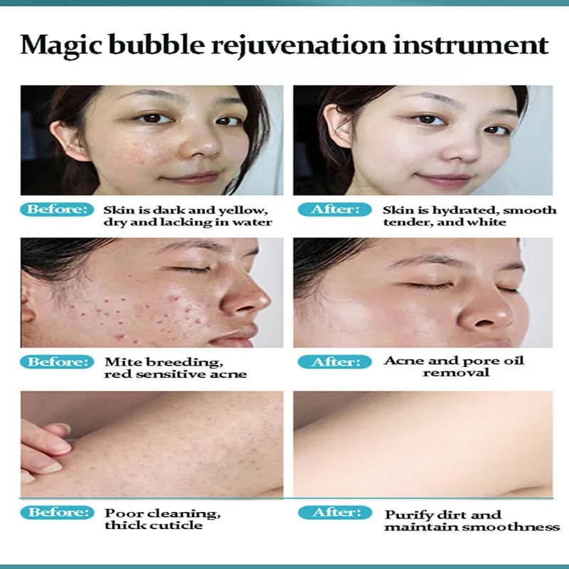 Solution magique d'oxygène actif d'eau de bulle de nettoyage de Rose pour la Machine automatique Instrument de beauté soins de la peau du visage livraison directe